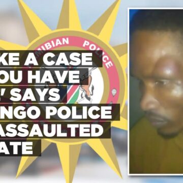 ‘Make a case if you have one’ says Erongo Police to assaulted inmate