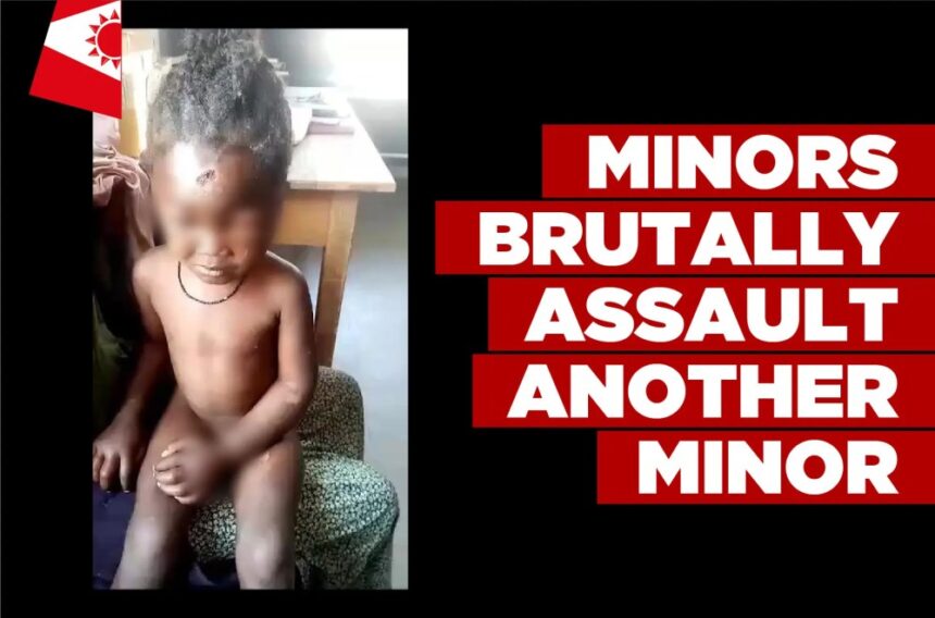 Minors brutally assault another minor