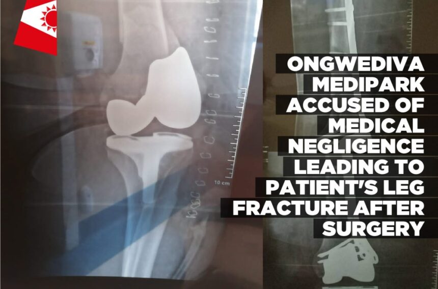 Ongwediva MediPark accused of medical negligence leading to patient’s leg fracture after surgery