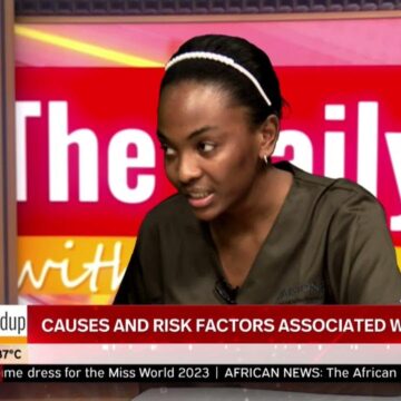 THE DAILY ROUNDUP WITH NINA  | CAUSES AND RISK FACTORS ASSOCIATED WITH ALOPECIA – nbc