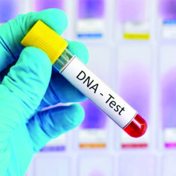 Politicians divided on compulsory DNA testing