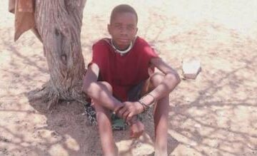 Kunene Haemophilia patient in despair