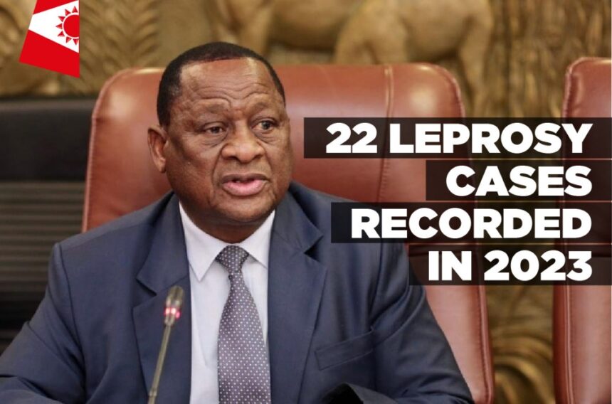 22 Leprosy cases recorded in 2023