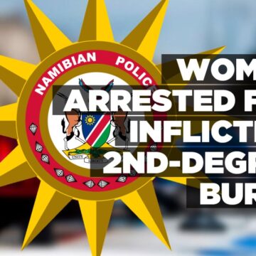 Woman arrested for inflicting 2nd-degree burns