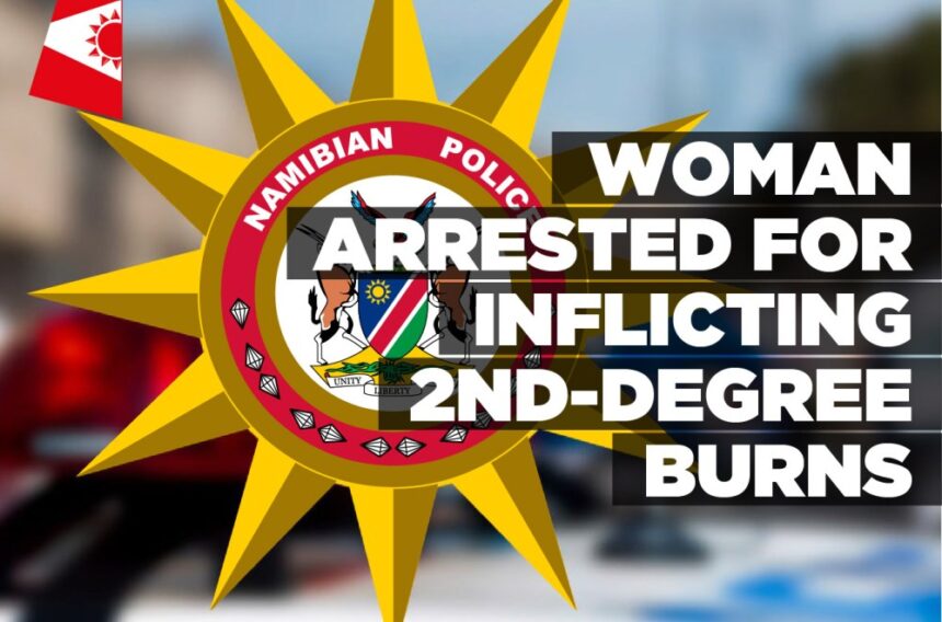 Woman arrested for inflicting 2nd-degree burns